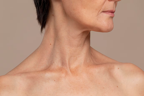 How to Prevent Aging of the Neck and Chest