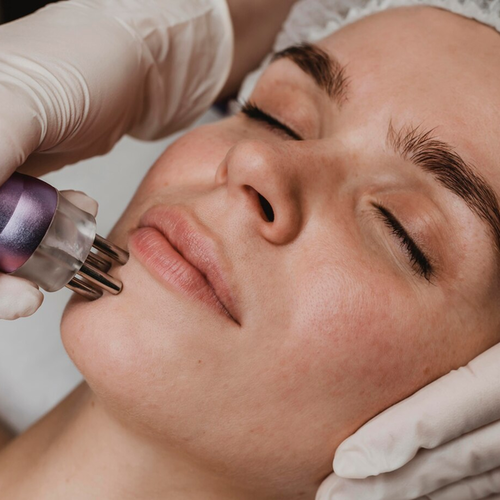 Diamond Microdermabrasion